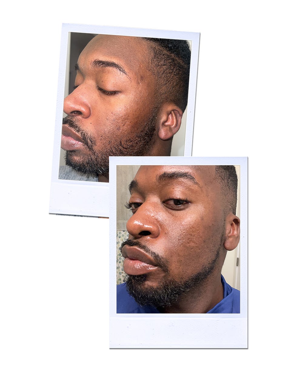 [Titre du site] Revue du sérum anti-taches Mela B3 de La Roche-Posay