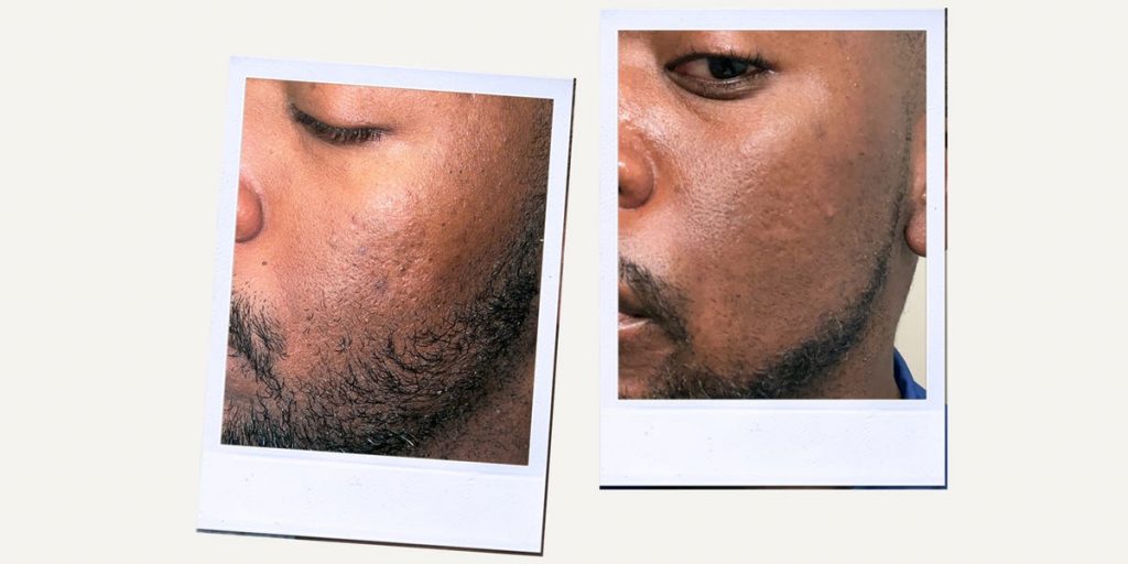 Revue du sérum anti-taches Mela B3 de La Roche-Posay