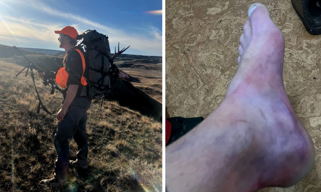 J'ai détruit ma jambe en emballant mon cerf et j'aurais pu mourir