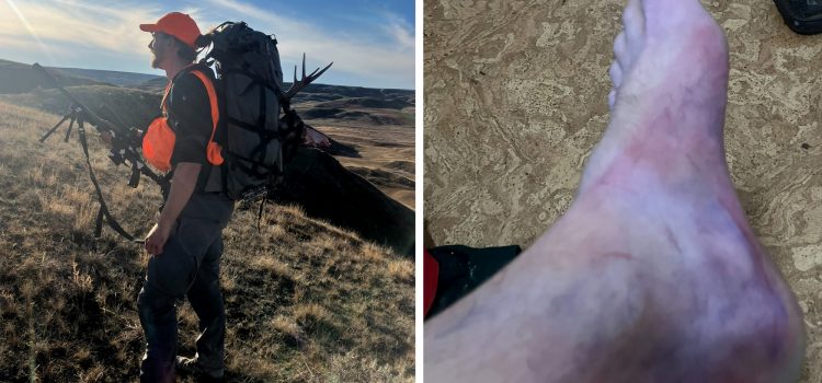 J’ai détruit ma jambe en emballant mon cerf et j’aurais pu mourir J'ai détruit ma jambe en emballant mon cerf et j'aurais pu mourir