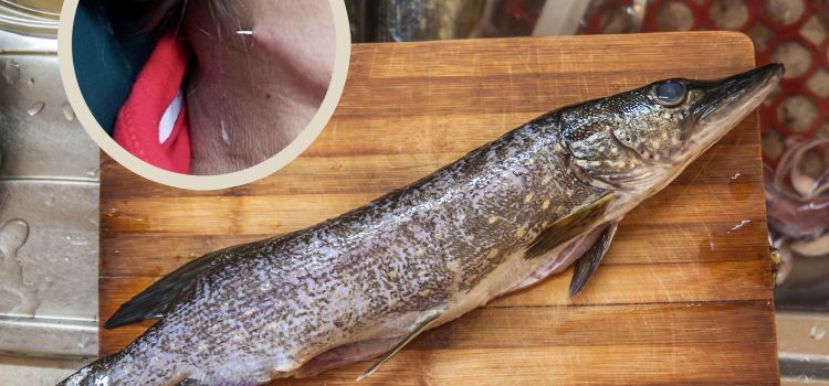 Fish Bone Perce le cou de la femme thaïlandaise – une histoire édifiante sur la consommation de poisson Fish Bone Perce le cou de la femme thaïlandaise - une histoire édifiante sur la consommation de poisson