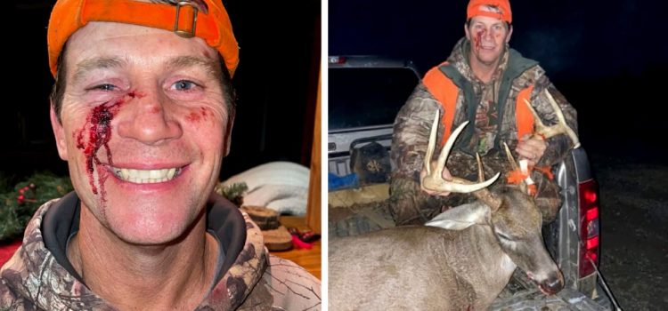 J'ai failli perdre mon œil en luttant contre un dollar
