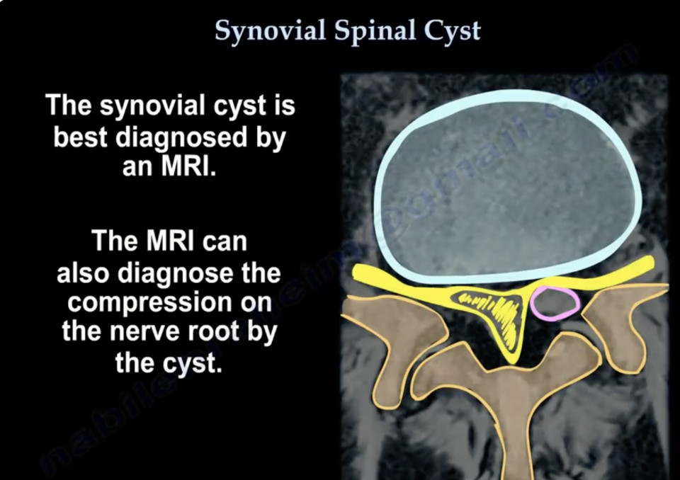 [Titre du site] Soulagement des douleurs lombaires grâce à des techniques de rééducation